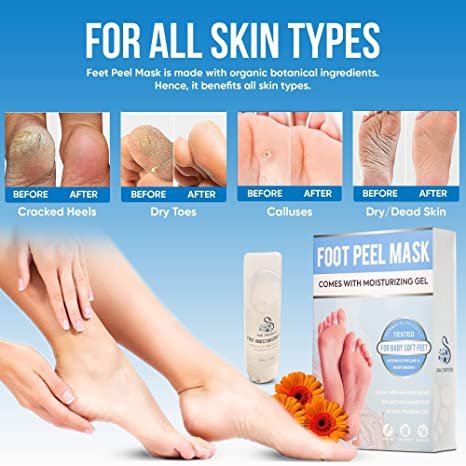 Foot Peel Mask for Dry Cracked Feet with Moisturizing Gel - Image 5