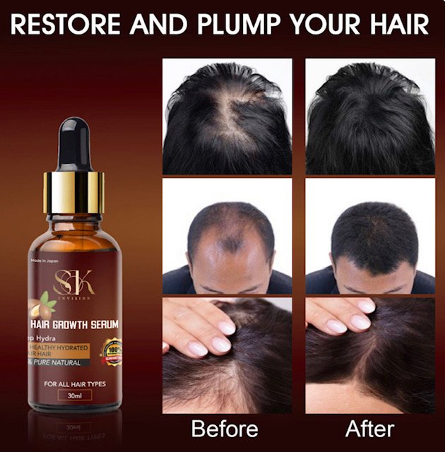 Hair Serum Regrowth of Hair, extracted from Organic & Natural ingrediants